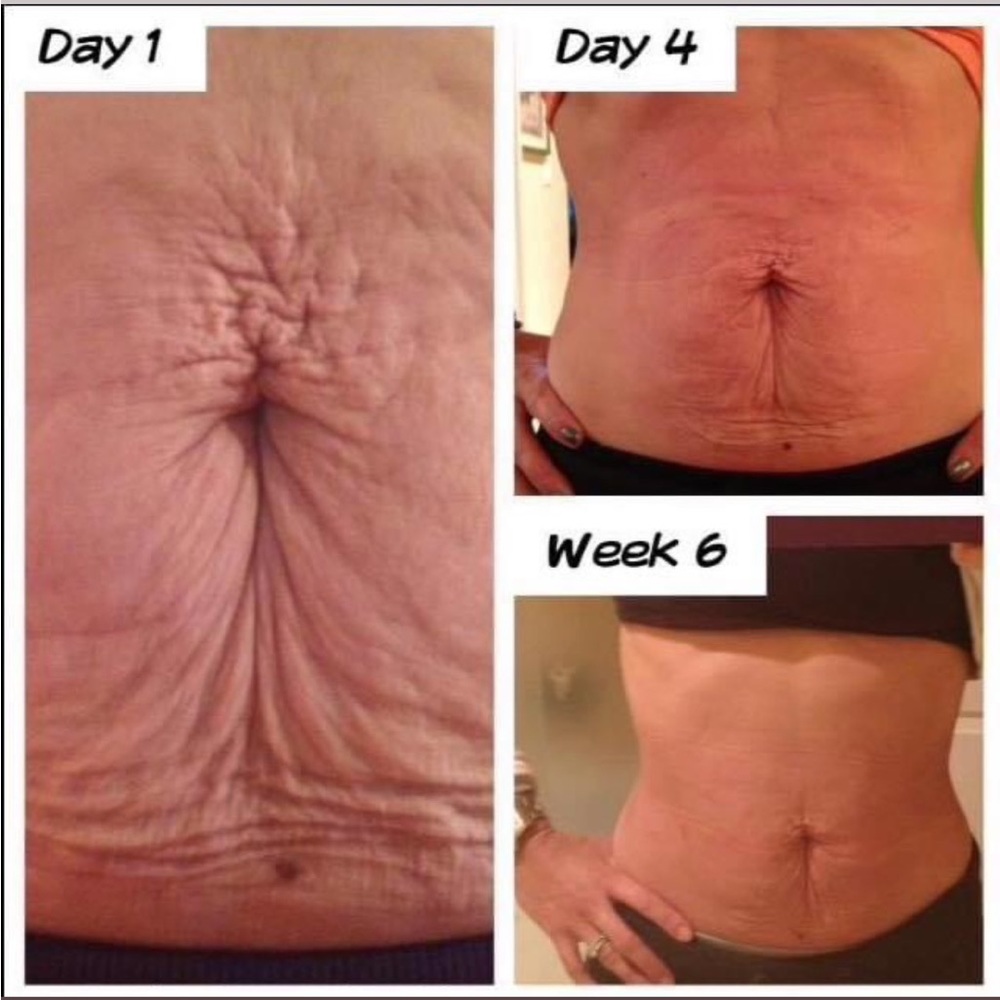 Nu Skin Dermatic Effects cellulite firming cream - Picture 8 of 16